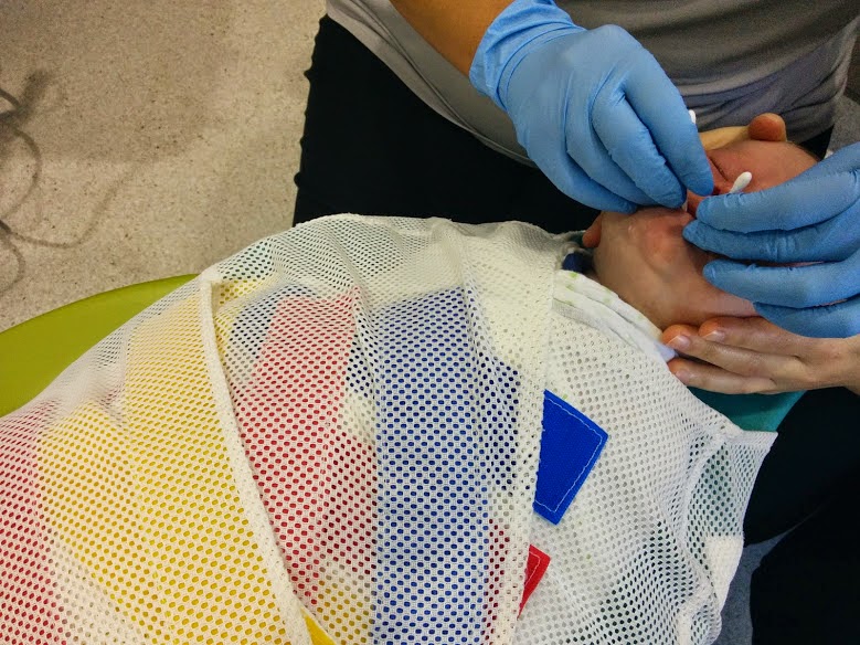 Baby during a tongue tie operation